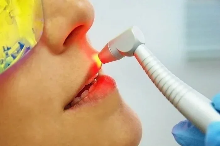 Especialidade Laserterapia